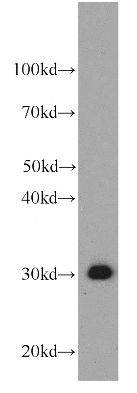 HepG2 cells were subjected to SDS PAGE followed by western blot with Catalog No:107245(ECHS1 antibody) at dilution of 1:1000