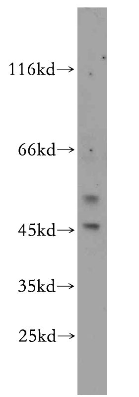HeLa cells were subjected to SDS PAGE followed by western blot with Catalog No:110421(EYA2 antibody) at dilution of 1:100
