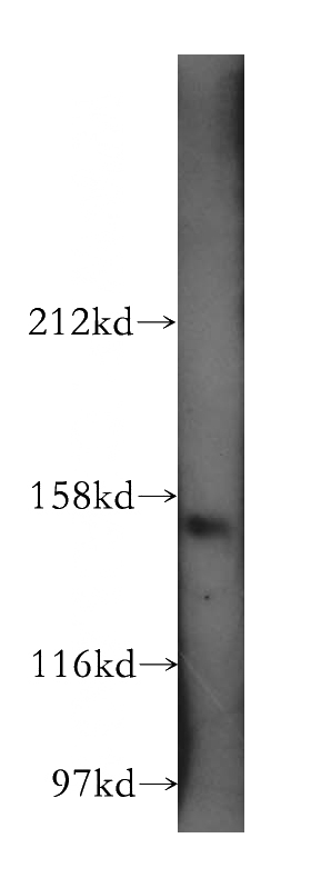 mouse thymus tissue were subjected to SDS PAGE followed by western blot with Catalog No:108121(AP3B1 antibody) at dilution of 1:500