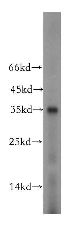 HeLa cells were subjected to SDS PAGE followed by western blot with Catalog No:111045(GOLPH3 antibody) at dilution of 1:500