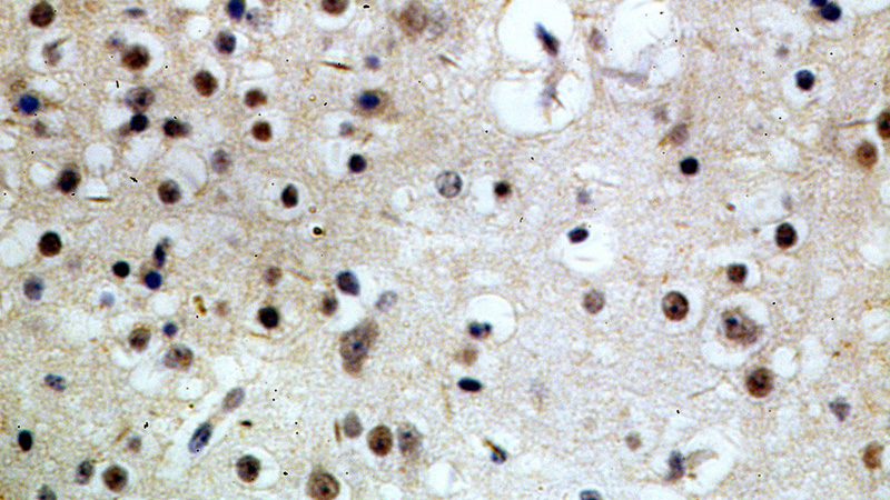 Immunohistochemical of paraffin-embedded human brain using Catalog No:111308(HEY1 antibody) at dilution of 1:100 (under 40x lens)