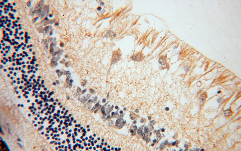 Immunohistochemical of paraffin-embedded human eye using Catalog No:107958(ALDH1A1 antibody) at dilution of 1:100 (under 40x lens)