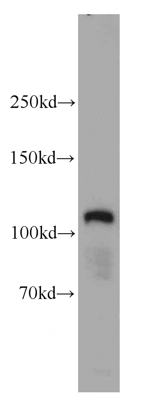 human brain tissue were subjected to SDS PAGE followed by western blot with Catalog No:112542(MCC antibody) at dilution of 1:500