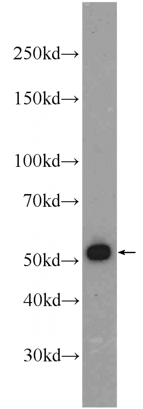 Jurkat cells were subjected to SDS PAGE followed by western blot with Catalog No:109094(CDC20 Antibody) at dilution of 1:800