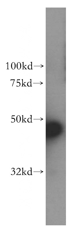 human heart tissue were subjected to SDS PAGE followed by western blot with Catalog No:113625(PDK2 antibody) at dilution of 1:500
