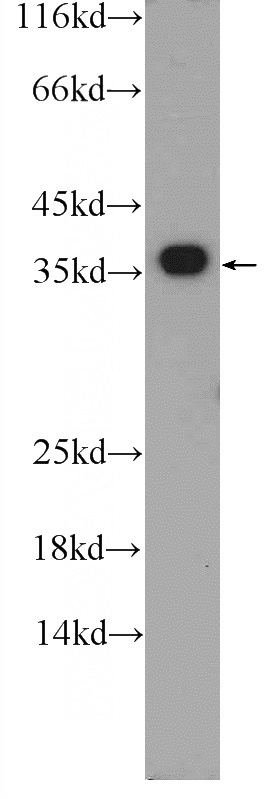 MCF-7 cells were subjected to SDS PAGE followed by western blot with Catalog No:110413(EXOSC7 Antibody) at dilution of 1:600