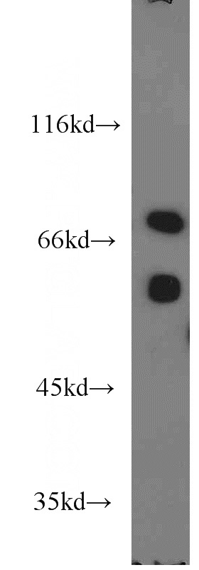 mouse liver tissue were subjected to SDS PAGE followed by western blot with Catalog No:112543(MCCC1 antibody) at dilution of 1:1200