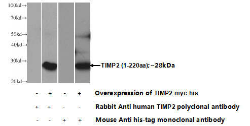 Transfected HEK-293 cells were subjected to SDS PAGE followed by western blot with Catalog No:116140(TIMP2 Antibody) at dilution of 1:1000