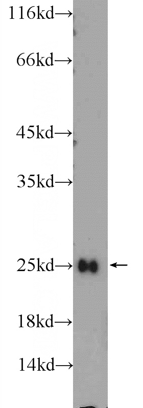 mouse brain tissue were subjected to SDS PAGE followed by western blot with Catalog No:110625(FEV Antibody) at dilution of 1:1000