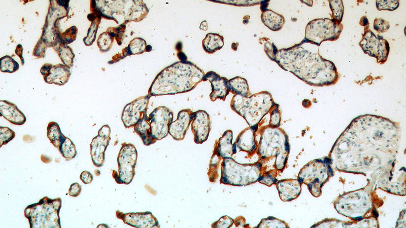Immunohistochemical of paraffin-embedded human placenta using Catalog No:117062(SLC39A8 antibody) at dilution of 1:100 (under 10x lens)
