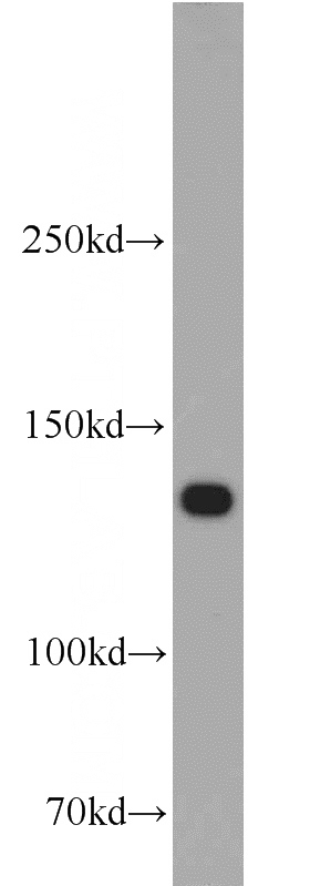 PC-3 cells were subjected to SDS PAGE followed by western blot with Catalog No:111858(ITGA3 antibody) at dilution of 1:500