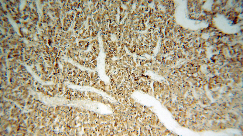 Immunohistochemical of paraffin-embedded human pituitary using Catalog No:108852(CPE antibody) at dilution of 1:50 (under 10x lens)