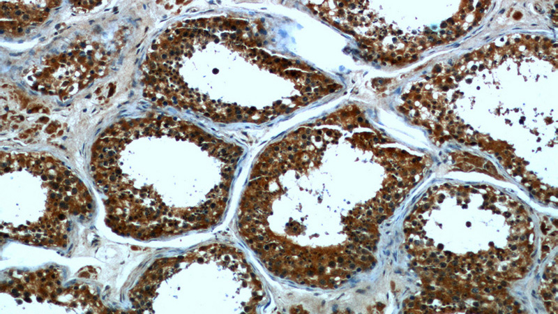 Immunohistochemical of paraffin-embedded human testis using Catalog No:107174(CPT1C antibody) at dilution of 1:50 (under 10x lens)