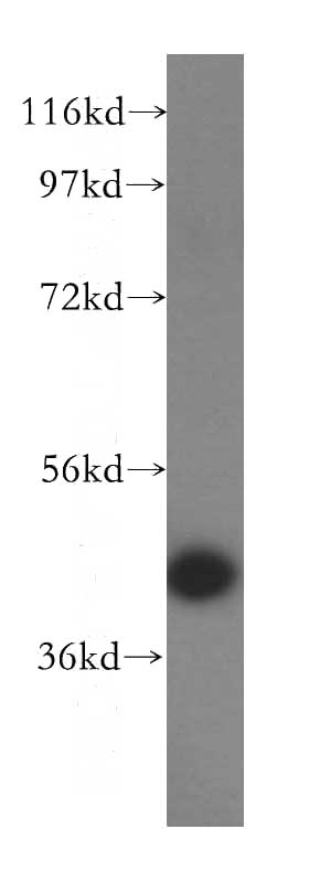 human kidney tissue were subjected to SDS PAGE followed by western blot with Catalog No:116805(VTA1 antibody) at dilution of 1:500