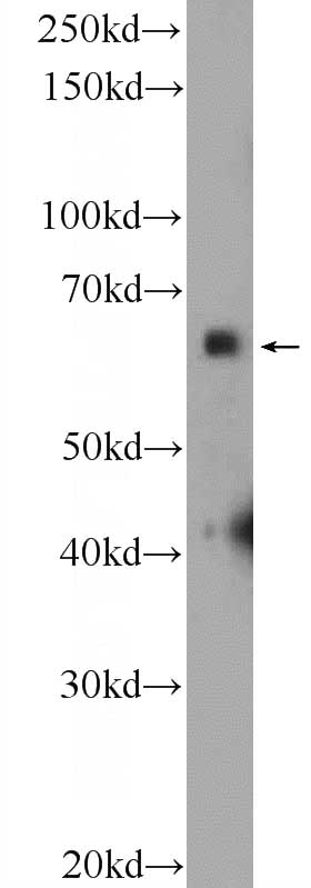 mouse brain tissue were subjected to SDS PAGE followed by western blot with Catalog No:115764(SYN2 Antibody) at dilution of 1:2000