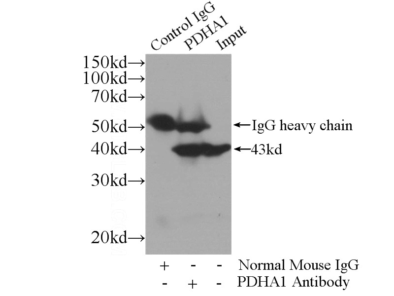 IP Result of anti-PDHA1 (IP:Catalog No:107461, 3ug; Detection:Catalog No:107461 1:10000) with HEK-293 cells lysate 1800ug.