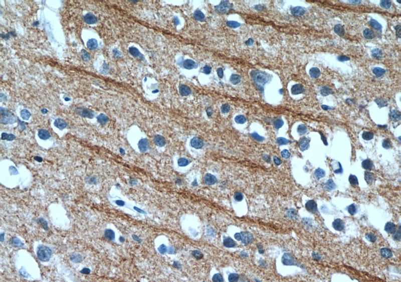 Immunohistochemistry of paraffin-embedded human brain tissue slide using Catalog No:113207(NPB Antibody) at dilution of 1:50 (under 40x lens)