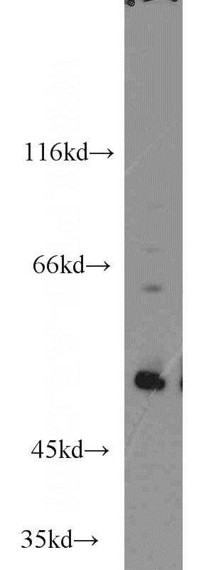 MCF7 cells were subjected to SDS PAGE followed by western blot with Catalog No:113553(P53 antibody) at dilution of 1:1000