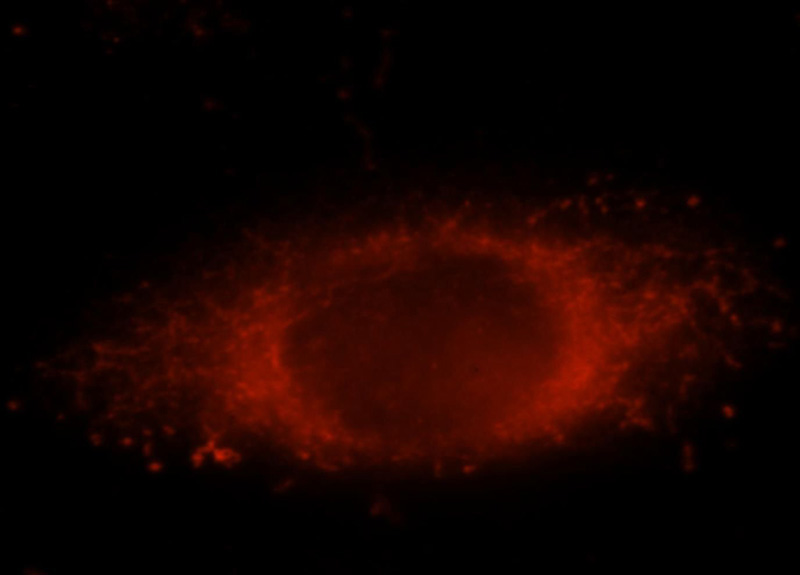 Immunofluorescent analysis of MCF-7 cells, using ALDH3A1 antibody Catalog No:107967 at 1:25 dilution and Rhodamine-labeled goat anti-rabbit IgG (red).