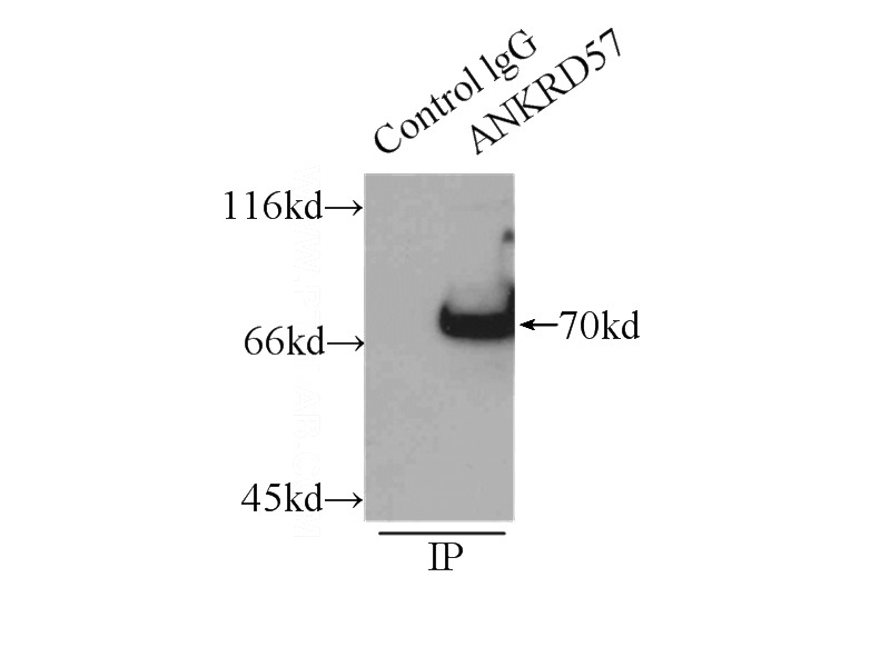 IP Result of anti-ANKRD57 (IP:Catalog No:108082, 3ug; Detection:Catalog No:108082 1:1000) with HeLa cells lysate 3000ug.