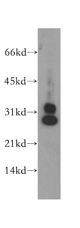 NIH/3T3 cells were subjected to SDS PAGE followed by western blot with Catalog No:109253(CENPH antibody) at dilution of 1:500