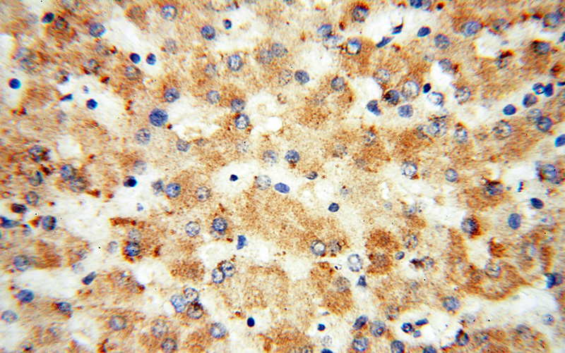Immunohistochemical of paraffin-embedded human liver using Catalog No:112356(LSS antibody) at dilution of 1:50 (under 40x lens)