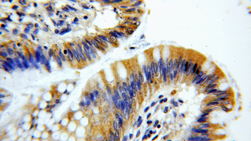 Immunohistochemical of paraffin-embedded human colon using Catalog No:112095(KLHL18 antibody) at dilution of 1:100 (under 40x lens)