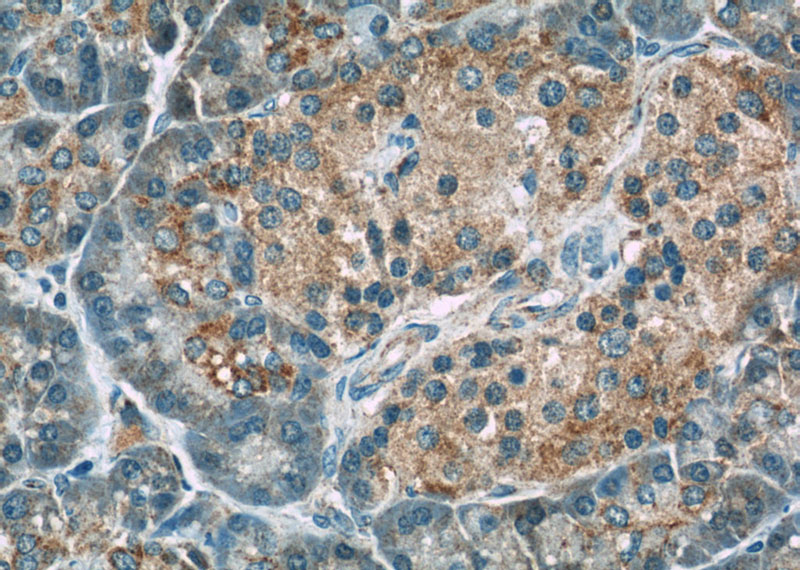 Immunohistochemistry of paraffin-embedded human pancreas slide using Catalog No:113718(PERK Antibody) at dilution of 1:50