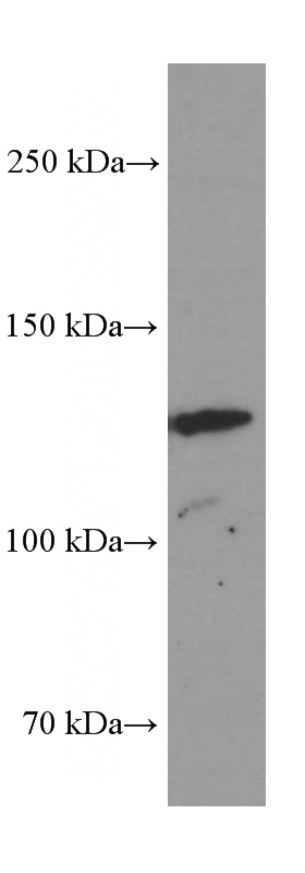 SGC-7901 cells were subjected to SDS PAGE followed by western blot with Catalog No:107582(AMOT Antibody) at dilution of 1:2000