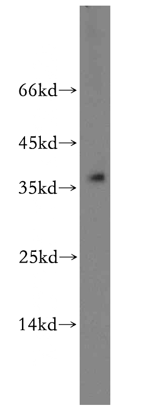 MCF7 cells were subjected to SDS PAGE followed by western blot with Catalog No:116401(TRNAU1AP,SECP43 antibody) at dilution of 1:400