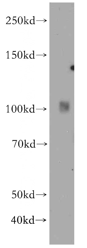 human heart tissue were subjected to SDS PAGE followed by western blot with Catalog No:111845(INPP5J antibody) at dilution of 1:500