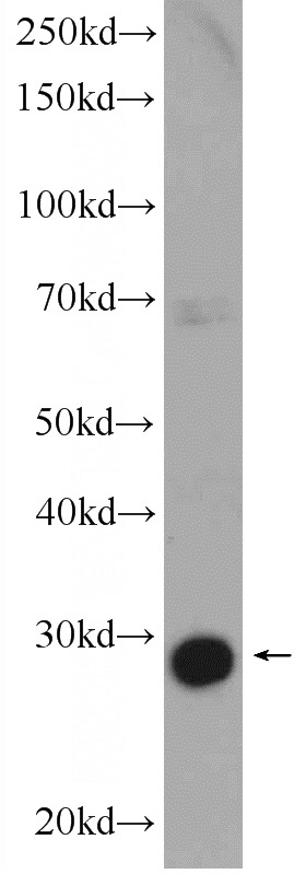 mouse heart tissue were subjected to SDS PAGE followed by western blot with Catalog No:107669(AACS Antibody) at dilution of 1:300