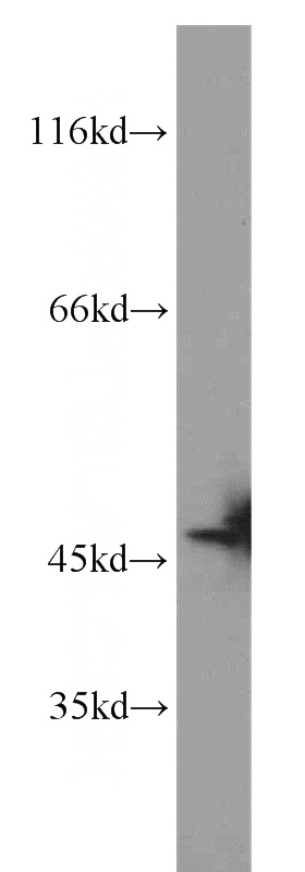 COLO 320 cells were subjected to SDS PAGE followed by western blot with Catalog No:115356(SLFNL1 antibody) at dilution of 1:800