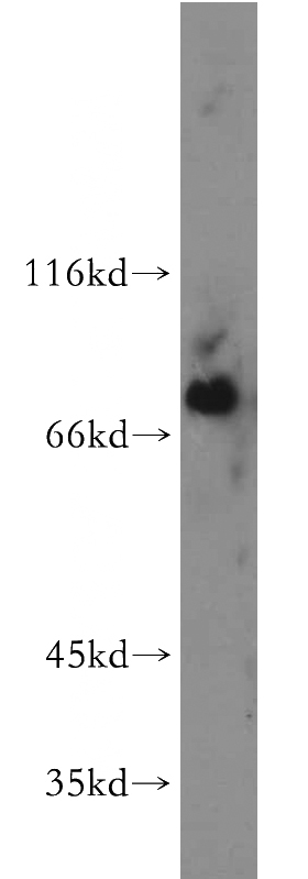mouse spleen tissue were subjected to SDS PAGE followed by western blot with Catalog No:108544(BTK antibody) at dilution of 1:300