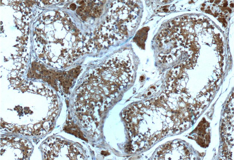Immunohistochemistry of paraffin-embedded human testis tissue slide using Catalog No:107489(PSMD4 Antibody) at dilution of 1:200 (under 10x lens)