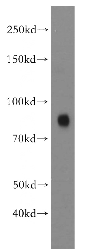 human brain tissue were subjected to SDS PAGE followed by western blot with Catalog No:110662(FBLN1 antibody) at dilution of 1:500