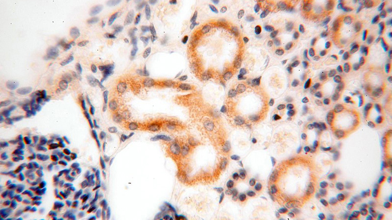 Immunohistochemical of paraffin-embedded human kidney using Catalog No:110846(GALNT14 antibody) at dilution of 1:200 (under 40x lens)