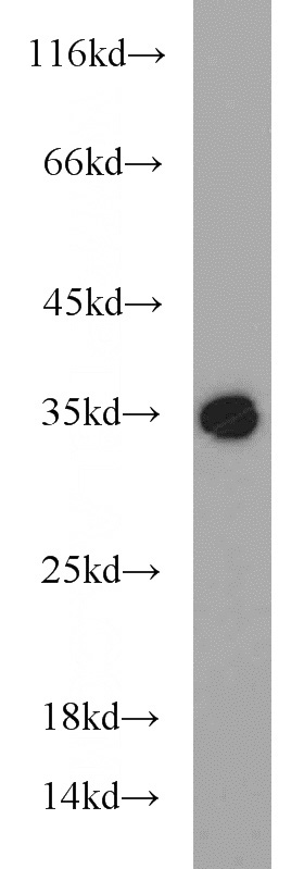 mouse eye tissue were subjected to SDS PAGE followed by western blot with Catalog No:114719(RLBP1 antibody) at dilution of 1:500