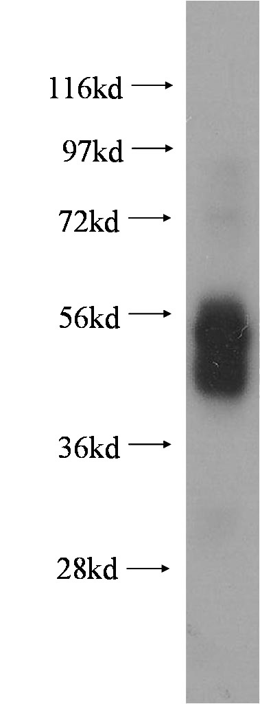 human spleen tissue were subjected to SDS PAGE followed by western blot with Catalog No:110567(FCER1A antibody) at dilution of 1:800
