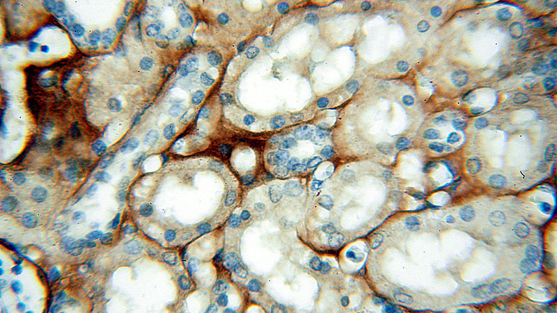 Immunohistochemical of paraffin-embedded human kidney using Catalog No:115945(TNXB antibody) at dilution of 1:50 (under 40x lens)