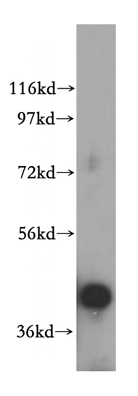 K-562 cells were subjected to SDS PAGE followed by western blot with Catalog No:114931(RRS1 antibody) at dilution of 1:500