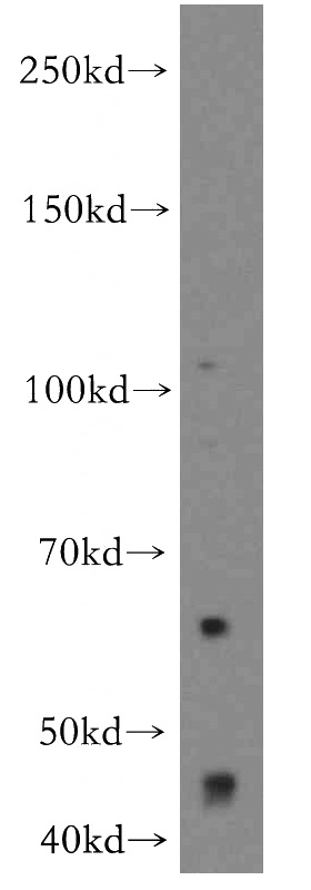 HeLa cells were subjected to SDS PAGE followed by western blot with Catalog No:113520(OVCA1 antibody) at dilution of 1:300
