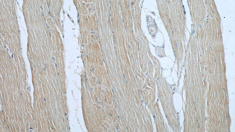 Immunohistochemical of paraffin-embedded human skeletal muscle using Catalog No:107492(RAB27A antibody) at dilution of 1:50 (under 10x lens)