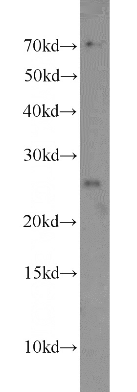 HepG2 cells were subjected to SDS PAGE followed by western blot with Catalog No:115458(SNRPB antibody) at dilution of 1:500