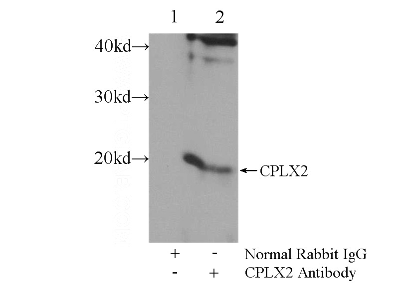 IP Result of anti-CPLX2 (IP:Catalog No:109511, 3ug; Detection:Catalog No:109511 1:700) with SH-SY5Y cells lysate 800ug.