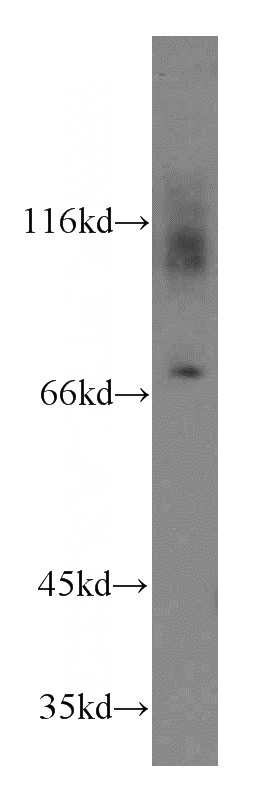 mouse liver tissue were subjected to SDS PAGE followed by western blot with Catalog No:112257(KCNA4-Specific antibody) at dilution of 1:500
