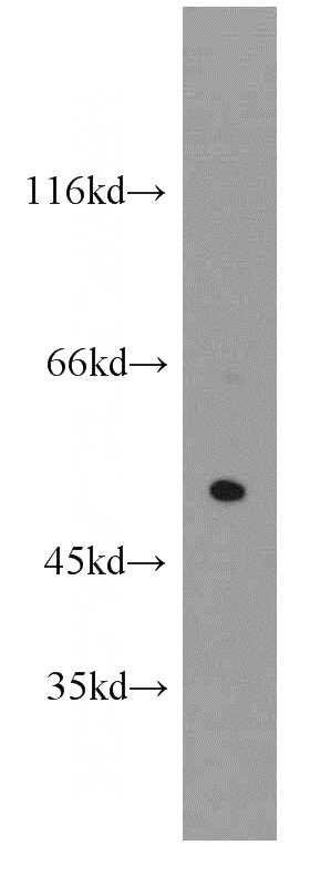 mouse lung tissue were subjected to SDS PAGE followed by western blot with Catalog No:109226(CHIA antibody) at dilution of 1:500