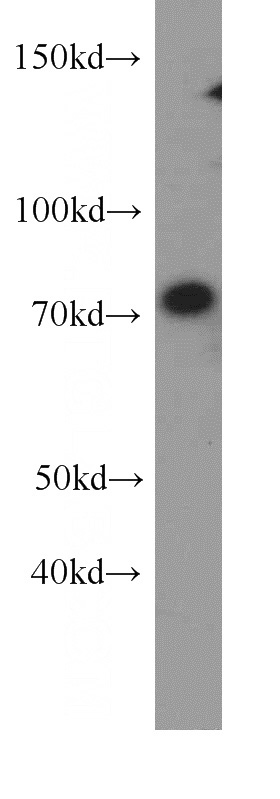 mouse liver tissue were subjected to SDS PAGE followed by western blot with Catalog No:113699(PCDHB5 antibody) at dilution of 1:800