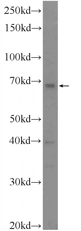 mouse kidney tissue were subjected to SDS PAGE followed by western blot with Catalog No:110040(DTX4 Antibody) at dilution of 1:300