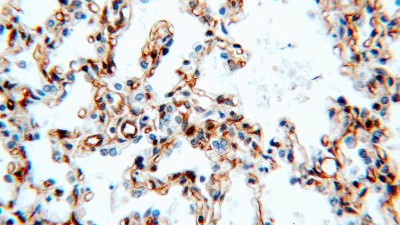 Immunohistochemical of paraffin-embedded human lung using Catalog No:115653(SPTBN1-Specific antibody) at dilution of 1:100 (under 40x lens)
